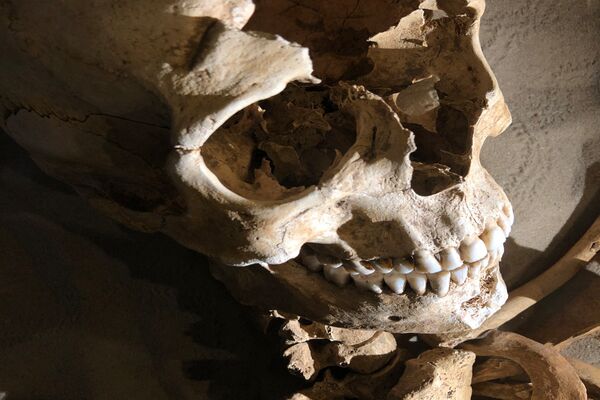 Schädel mit Frakturen, führt zur Anthropologie Sammlung